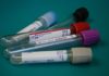 Things-to-Know-About-PCR,-Antibody,-&-Antigen-Tests-on-SuccesStuff