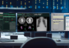 PACS system radiology vendors
