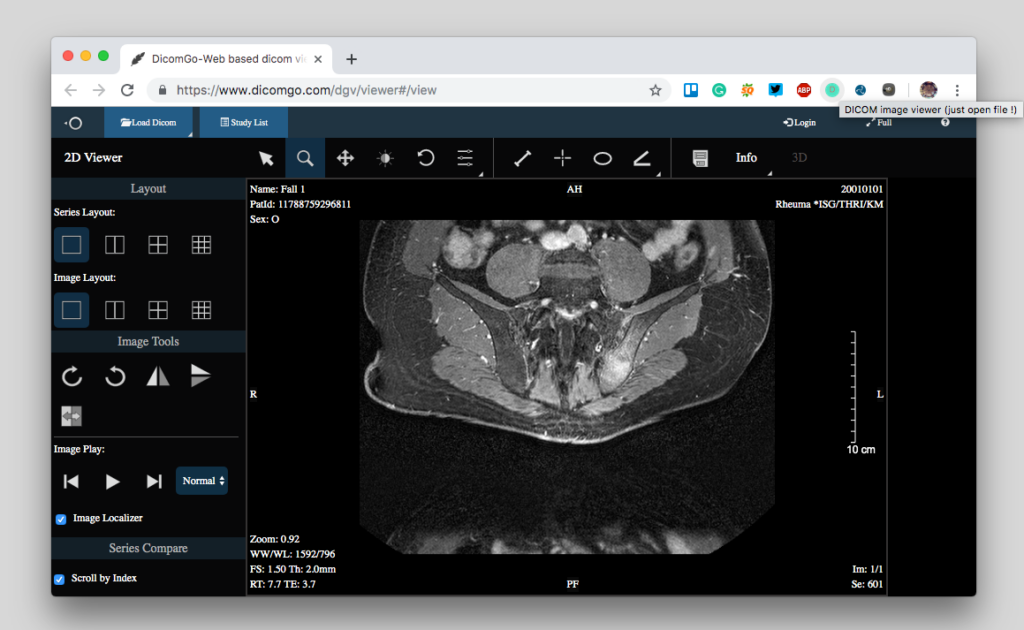 DICOM viewer web