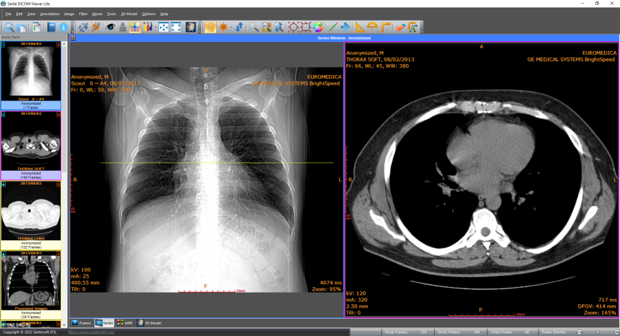 free DICOM viewer online