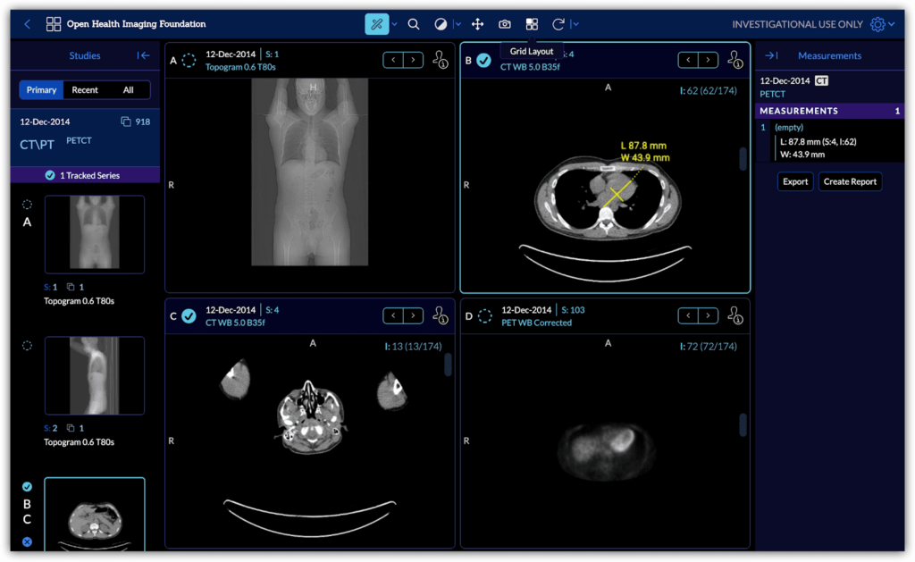 free DICOM viewer online